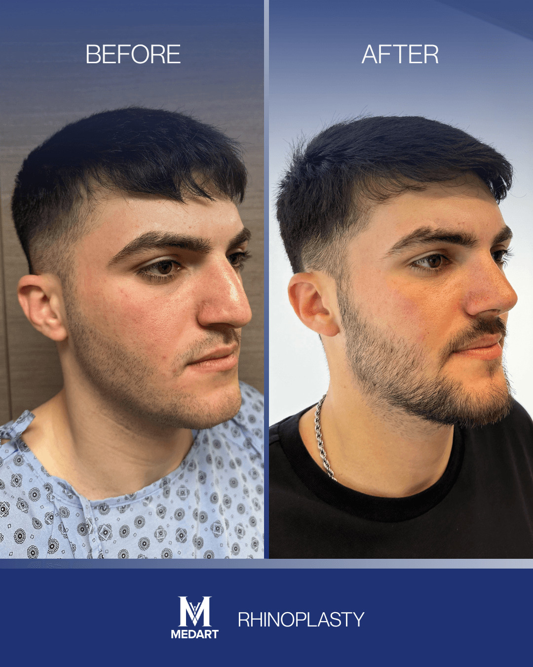Before After transformation 1