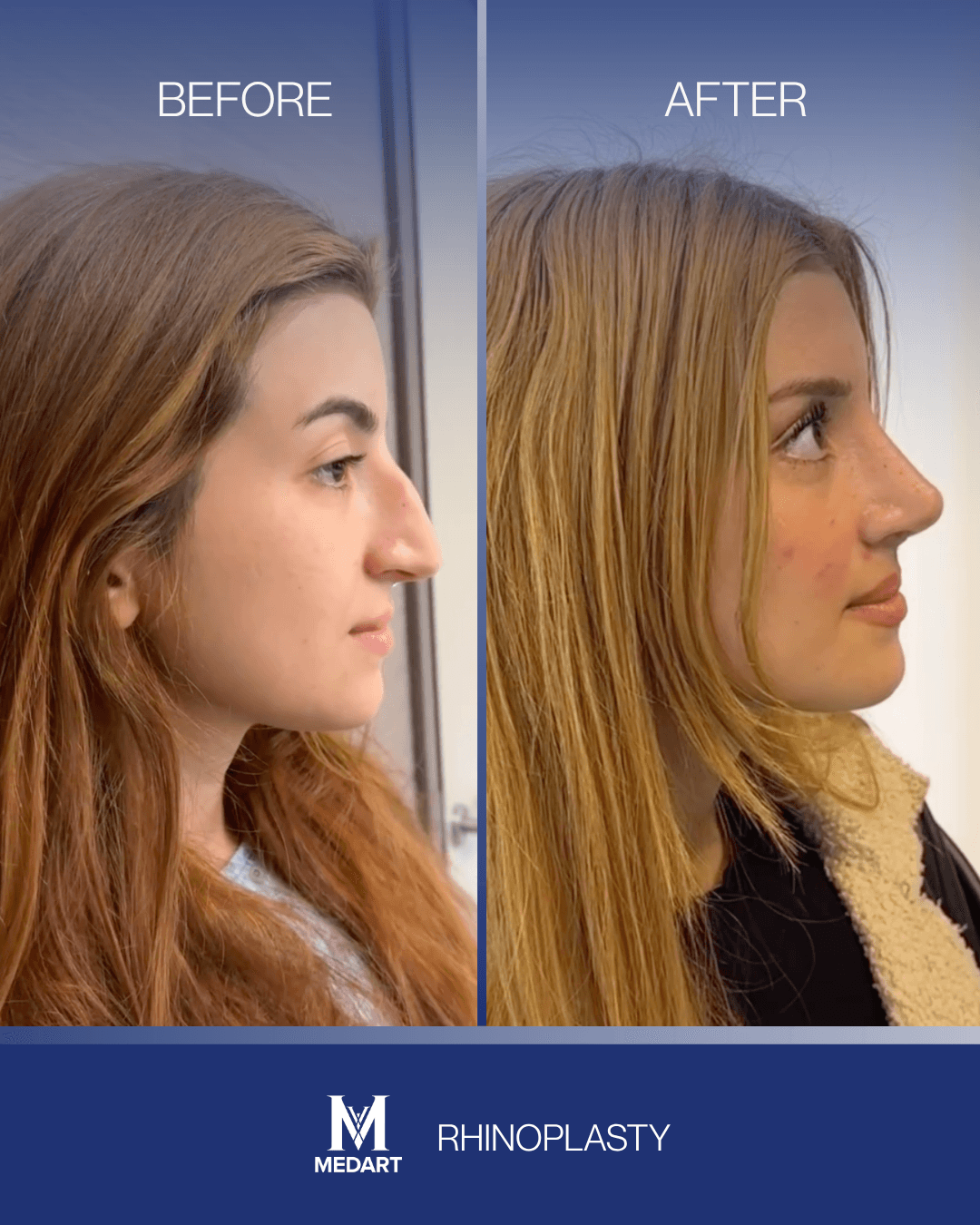 Before After transformation 11