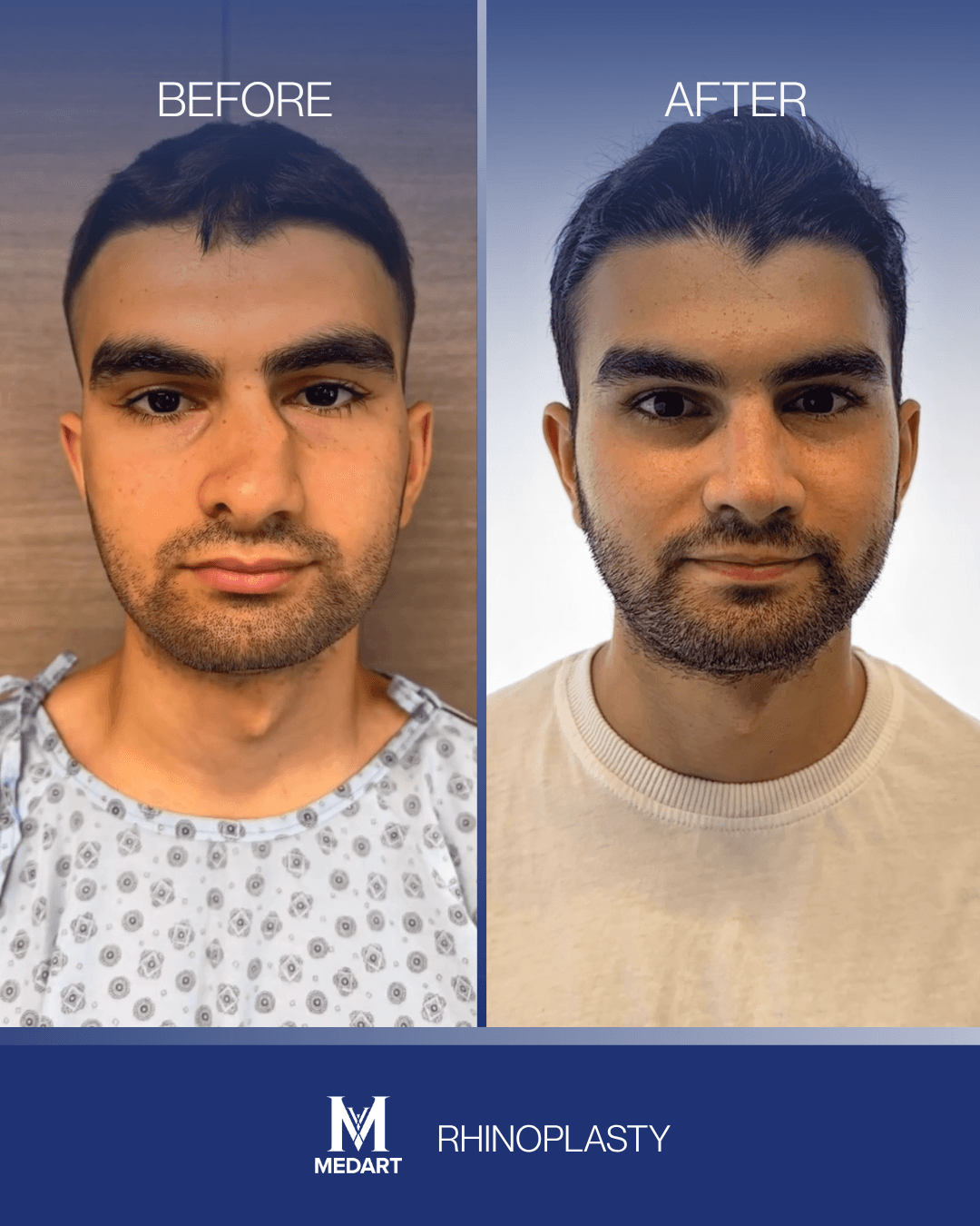 Before After transformation 12