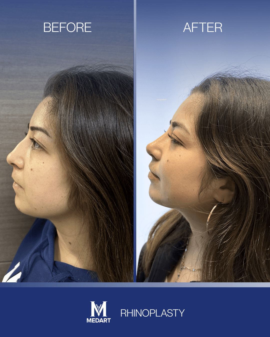 Before After transformation 2