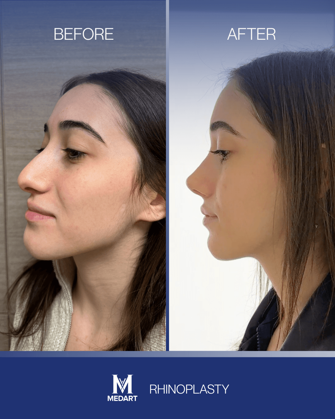 Before After transformation 5