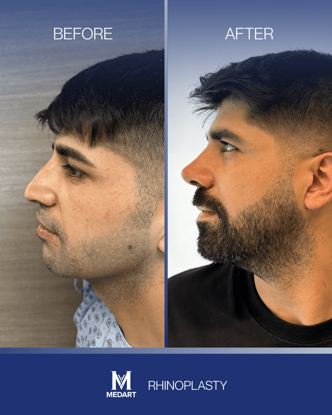 Before After transformation 6