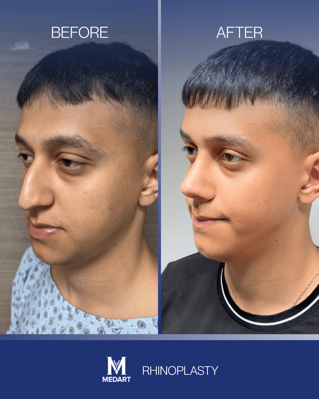 Before After transformation 7